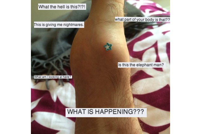 Man posts photo of a mysterious part of his body on Facebook, sending his friends into a spiral of confusion and horror.